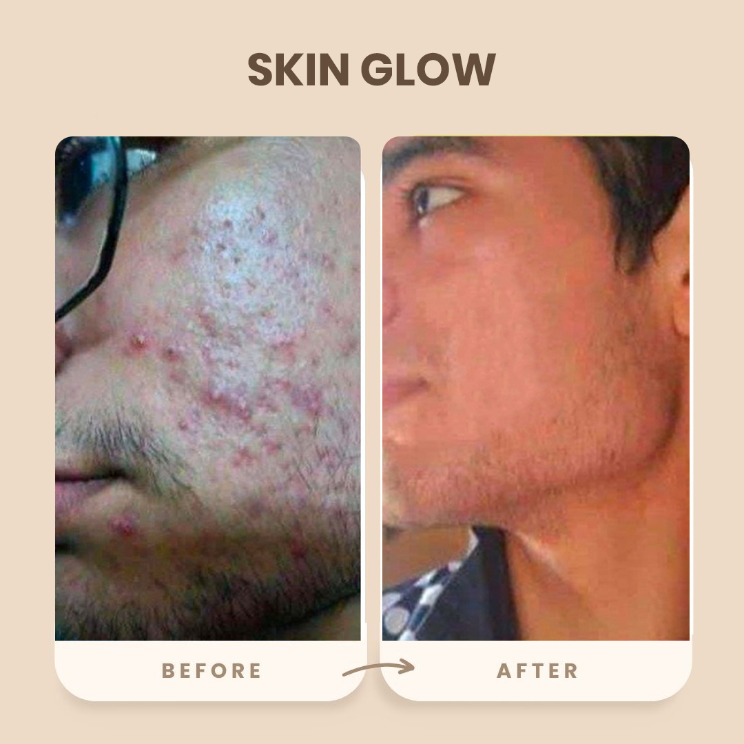 Transformation Result